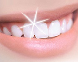 Aprende a cuidar tus dientes Aprende a cuidar tus dientes