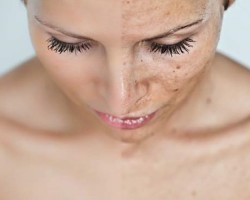 Cómo eliminar las manchas del rostro