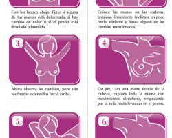 Cómo prevenir el cáncer de mama