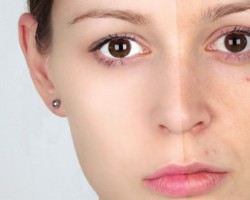 Aprender a eliminar las imperfecciones rápido