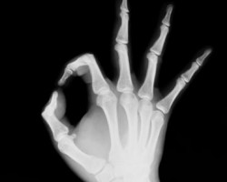 Cómo cuidar tus huesos