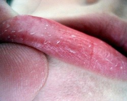 Consejos para hidratar los labios partidos