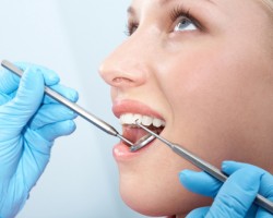 Cómo evitar las caries Cómo evitar las caries