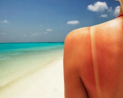 Como evitar quemarse con el sol